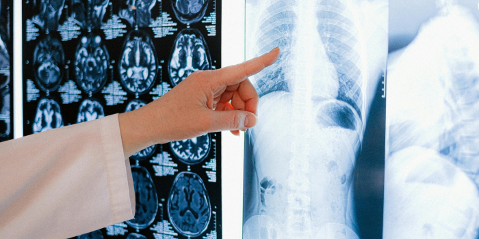 Attorney Dantonio Obtains Favorable Outcome on Preliminary Objections on Behalf of Radiologist